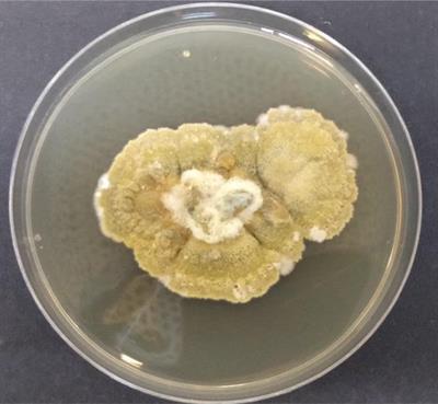 Antiproliferative Role of Secondary Metabolites From Aspergillus unguis AG 1.1 (G) Isolated From Marine Macroalgae Enteromorpha sp. by Inducing Intracellular ROS Production and Mitochondrial Membrane Potential Loss Leading to Apoptosis